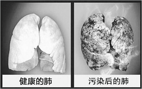 肺部.jpg